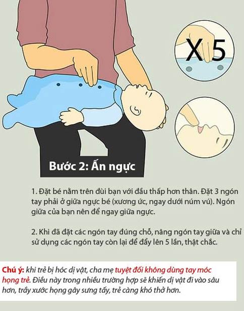 Kỹ năng sống: 6 kỹ năng sơ cứu cho trẻ Dubaipalace it com bắn cá, game bài, xổ số, live casino mà bố mẹ cần đặc biệt nắm chắc